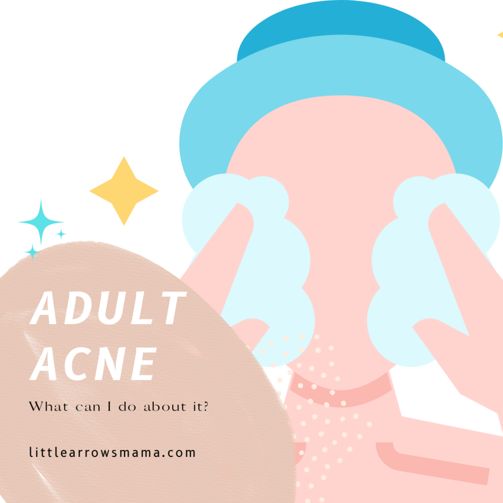 My Journey with Adult Acne